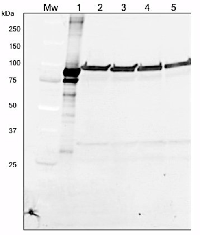 LOX | Lipoxygenase in the group Antibodies Plant/Algal  / Plant Developmental Biology / Lipid metabolism at Agrisera AB (Antibodies for research) (AS06 128)